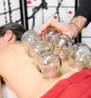 Cupping Therapy (Sports Recovery)