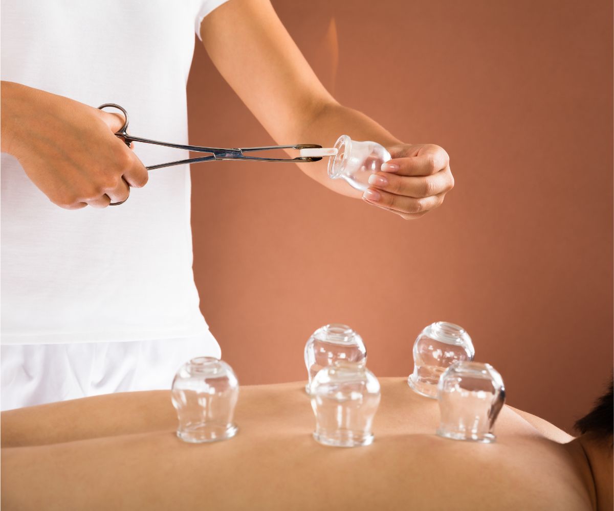 Cupping Therapy 